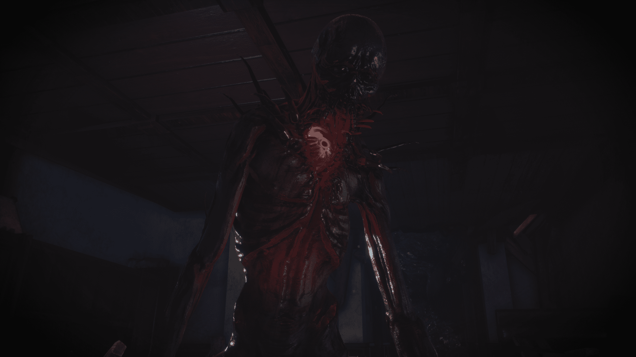 Fobia – St. Dinfna Hotel invites you to check out the survival horror’s latest trailer