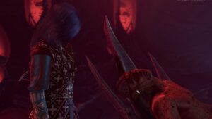 Baldur's Gate 3 how to save or destroy the brain: The player character encounters a pulsing brain in a human body in the game.